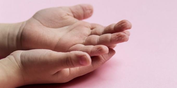 Körperreaktionen: Faltenbildung der Haut an den Fingern