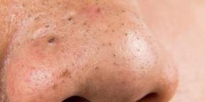 Es ist Zeit zu gestehen: Eine Gesichtsreinigung rettet Sie nicht vor verstopften und vergrößerten Poren