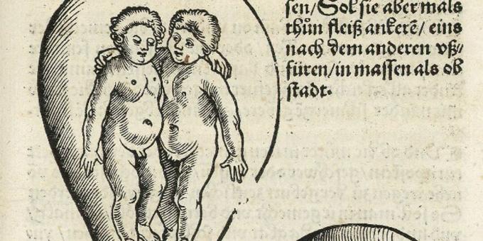 Kinder des Mittelalters: Zwillinge im Mutterleib, Eucharius Rodion