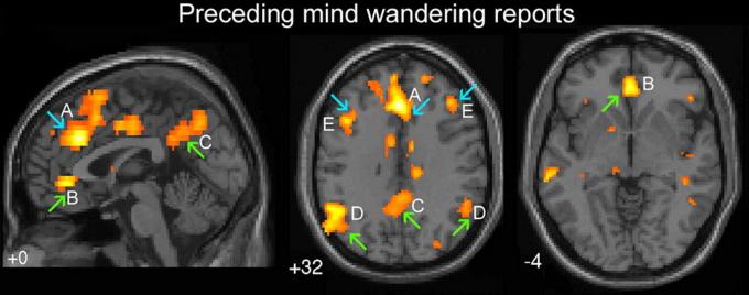 Grüne Pfeile zeigen Bereiche des Gehirns, die für „automatisches Verhalten“. Blauer Pfeil - der „Executive“ Teil des Gehirns. A - dorsal cingulate, B - ventralanya cingulate, C - Precuneus cerebralen Hemisphären, D - bilateral temporoparietalen Junction, E - dorsolateralen präfrontalen Kortex