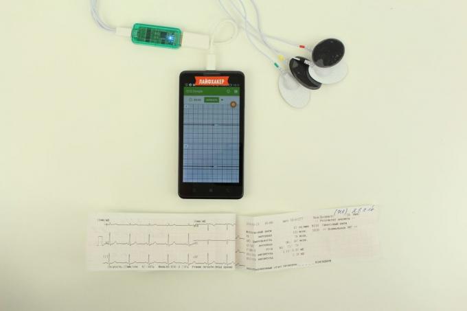 EKG-Dongle