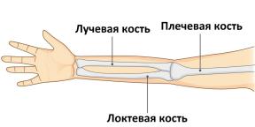 Wie man einen gebrochenen Arm erkennt und was als nächstes zu tun ist