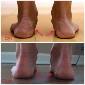 Wie in minimalistischen Schuhen ändern Füße laufen