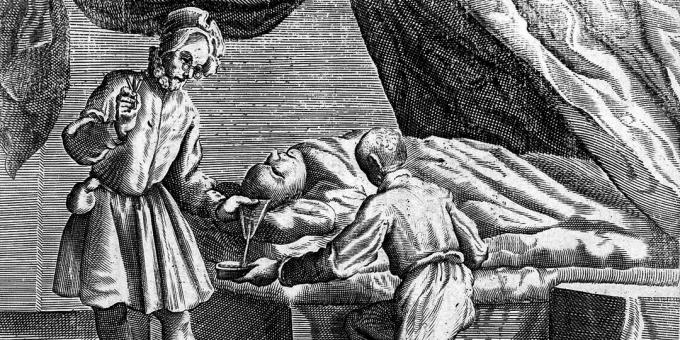 Mittelalterliche Medizin: Aderlass vom Kopf, Gravur von 1626