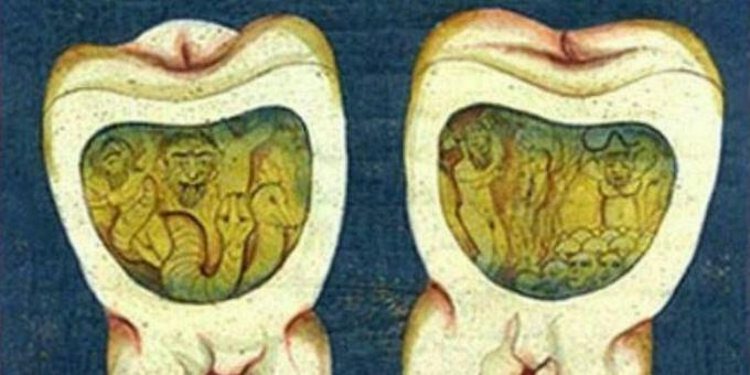 Mittelalterliche Medizin: Eine Seite aus der osmanischen Zahnabhandlung, 17. Jahrhundert.